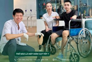 Thế nào là mỏm cụt tốt