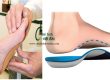 nẹp bàn hiệu quả