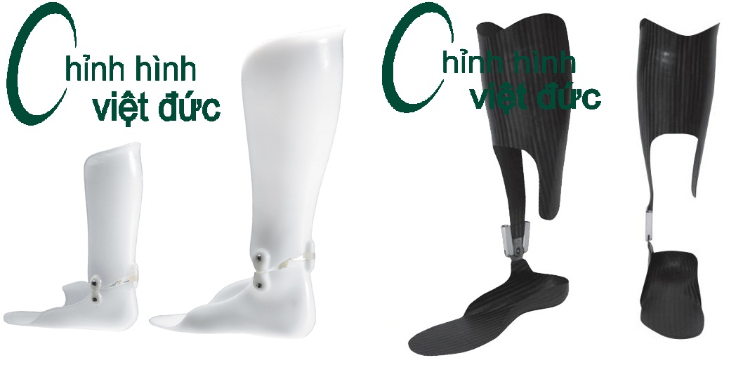 nẹp mắt cá chất lượng