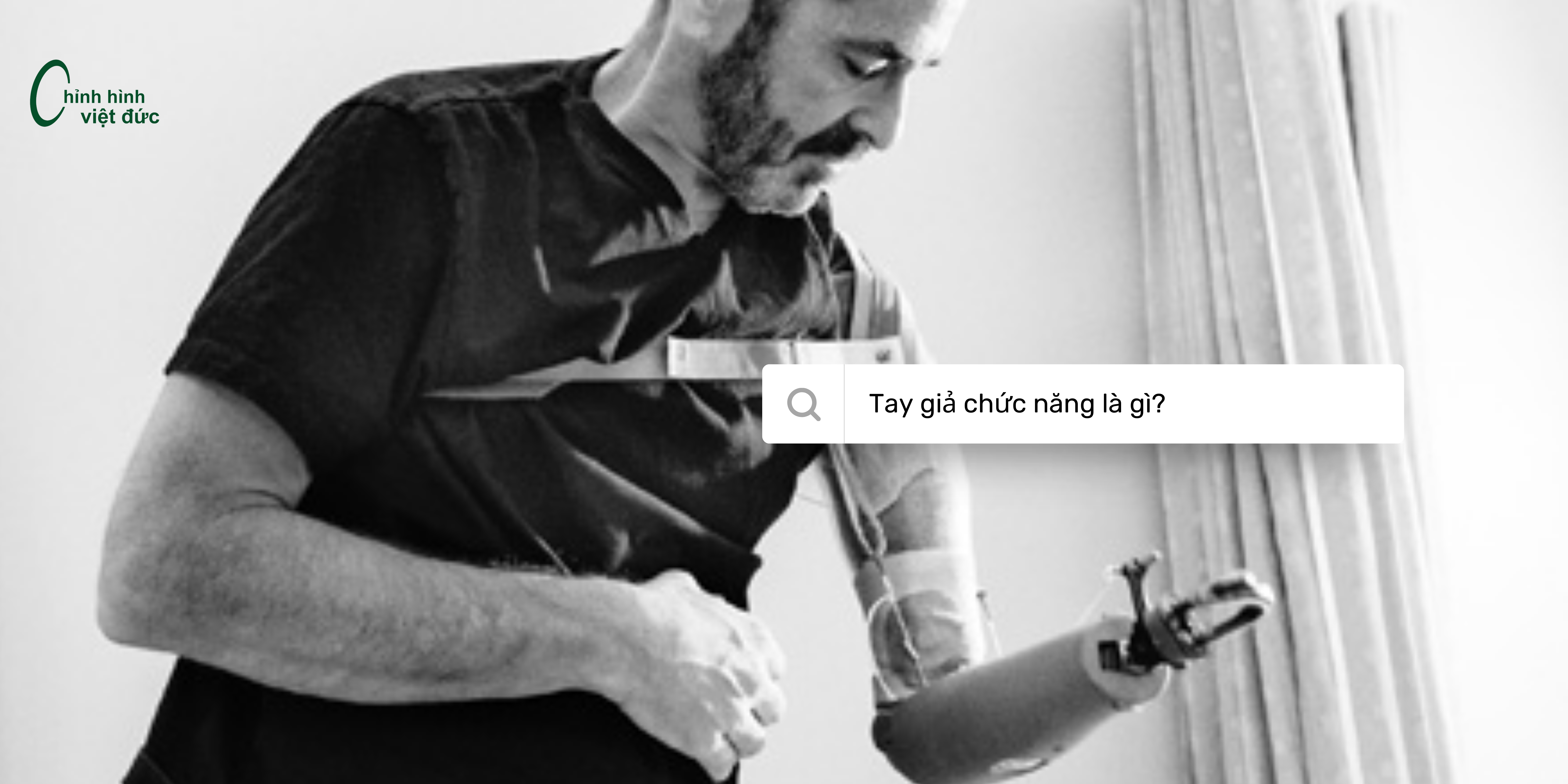 tay giả trên khuỷu giá bao nhiêu?