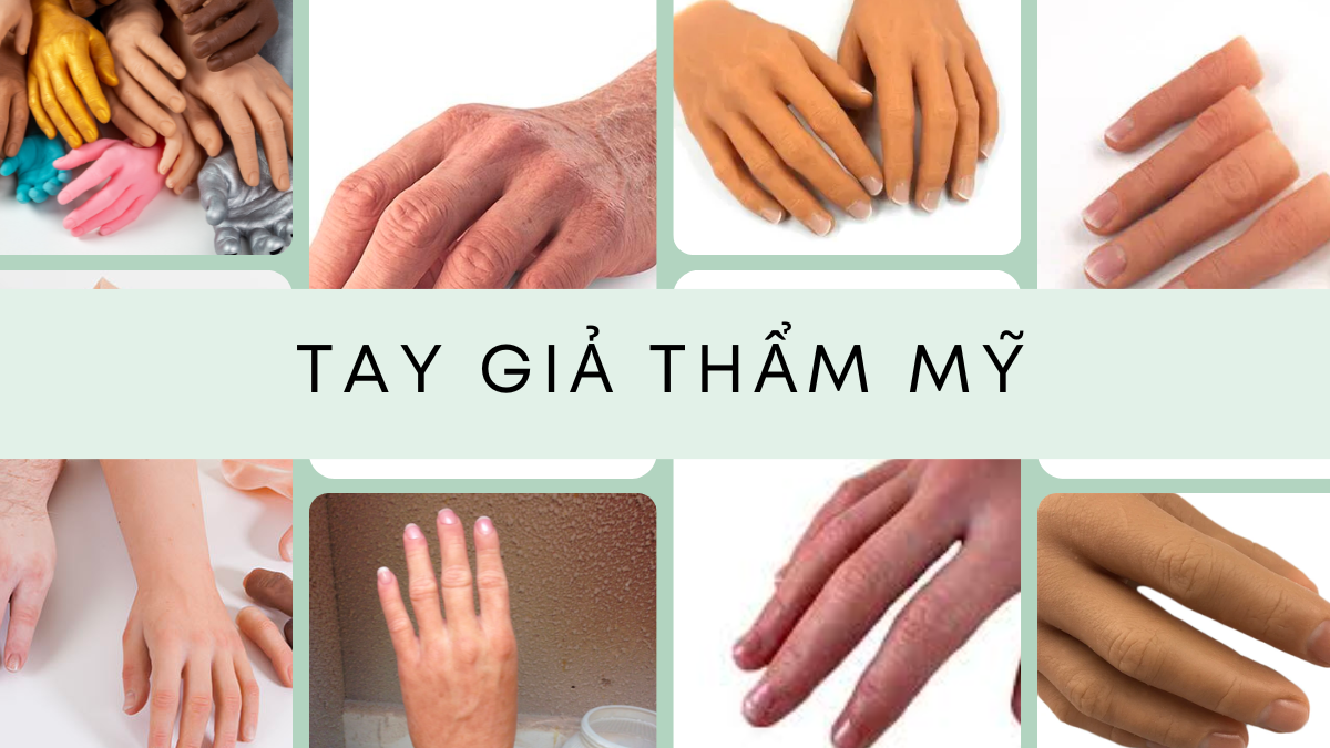 tay giả thẩm mỹ giá bao nhiêu