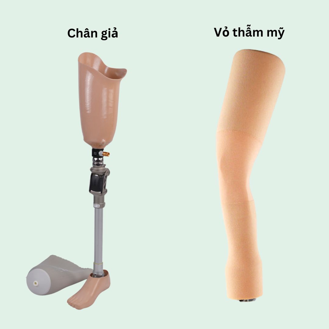bọc thẩm mỹ chân trên gối
