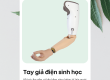 địa chỉ làm tay giả điện