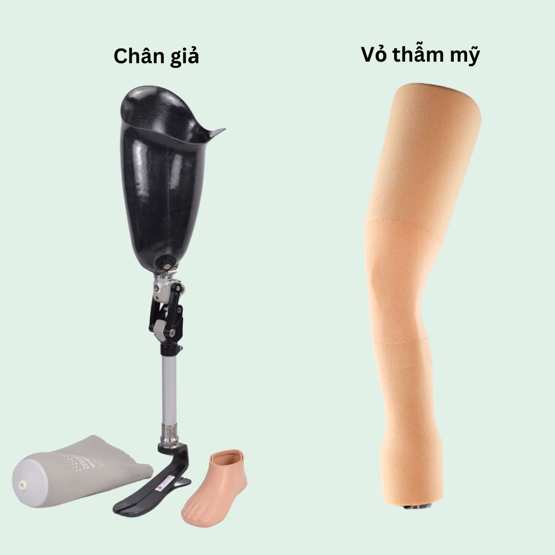 bọc thẩm mỹ chân trên gối
