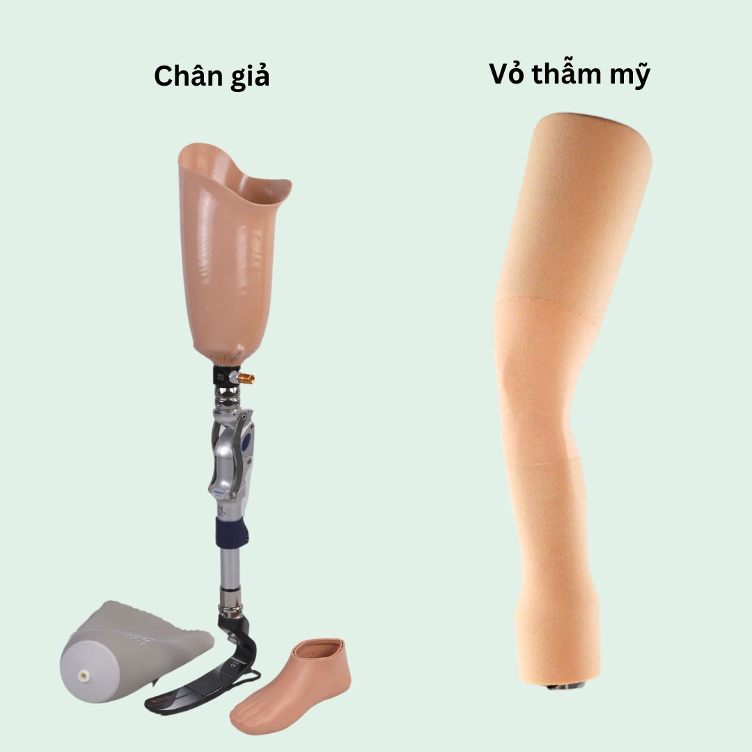 bọc thẩm mỹ chân trên gối