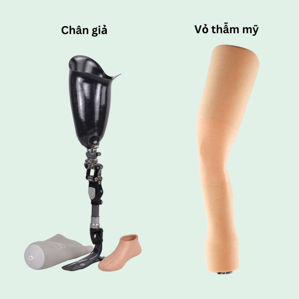 bọc thẩm mỹ chân trên gối