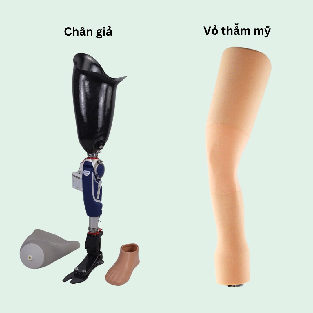 bọc thẩm mỹ chân trên gối
