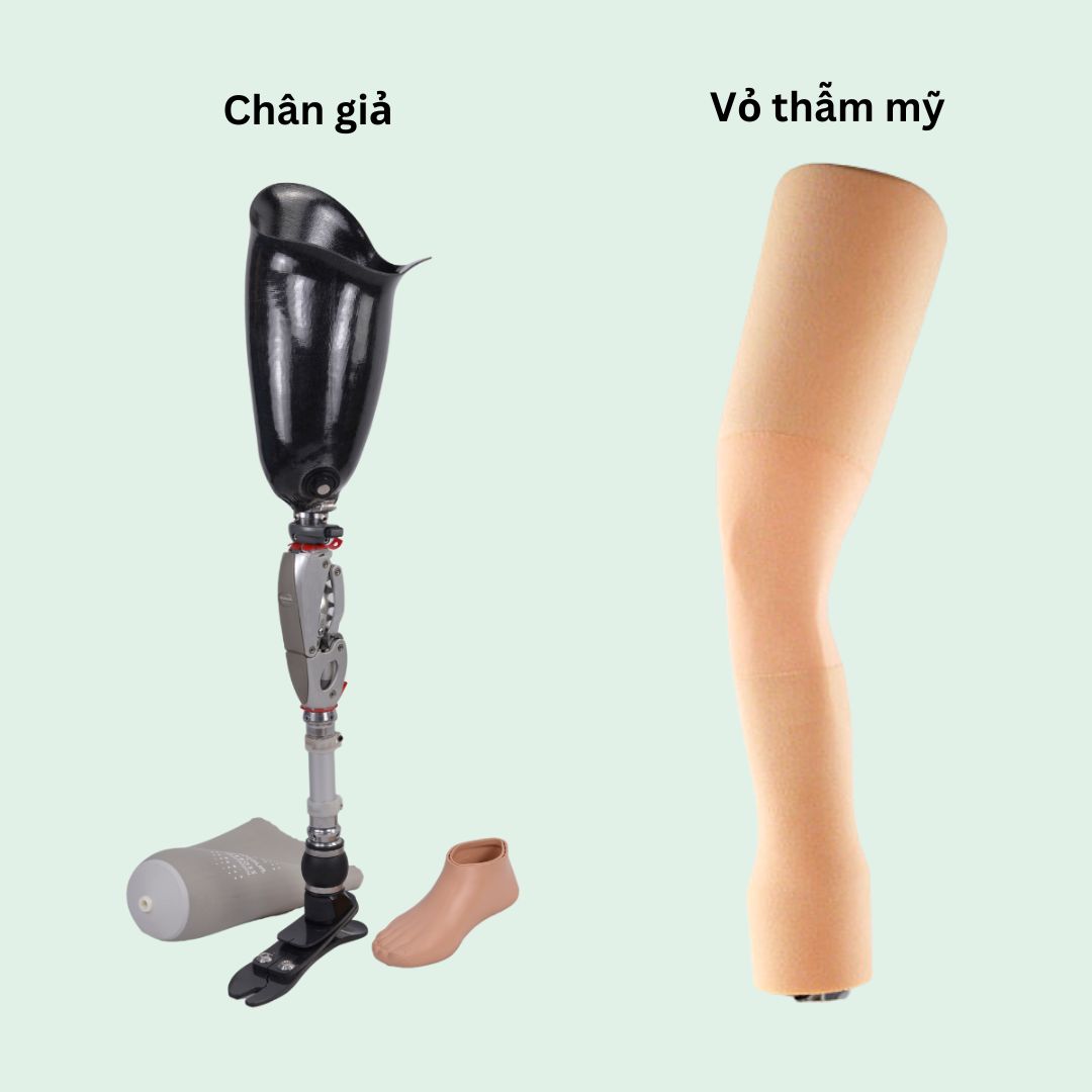bọc thẩm mỹ chân trên gối
