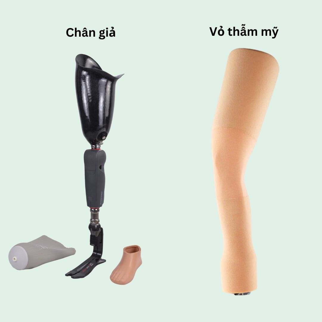 bọc thẩm mỹ chân trên gối