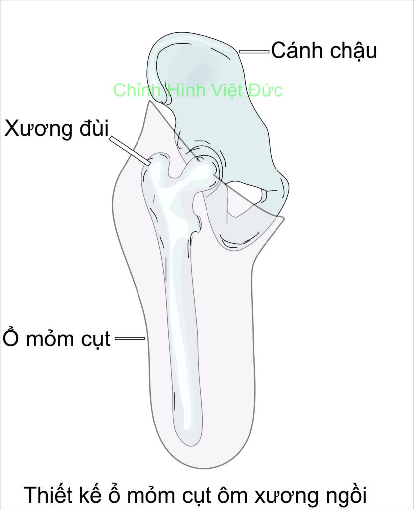 thiết kế mỏm cụt ôm xương ngồi