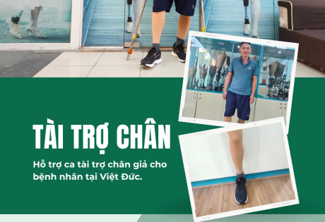 tài trợ chân giả trên gối