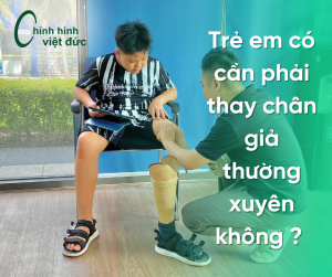 chân giả cho trẻ em có cần thay thường xuyên không