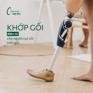 khớp gối điện tử