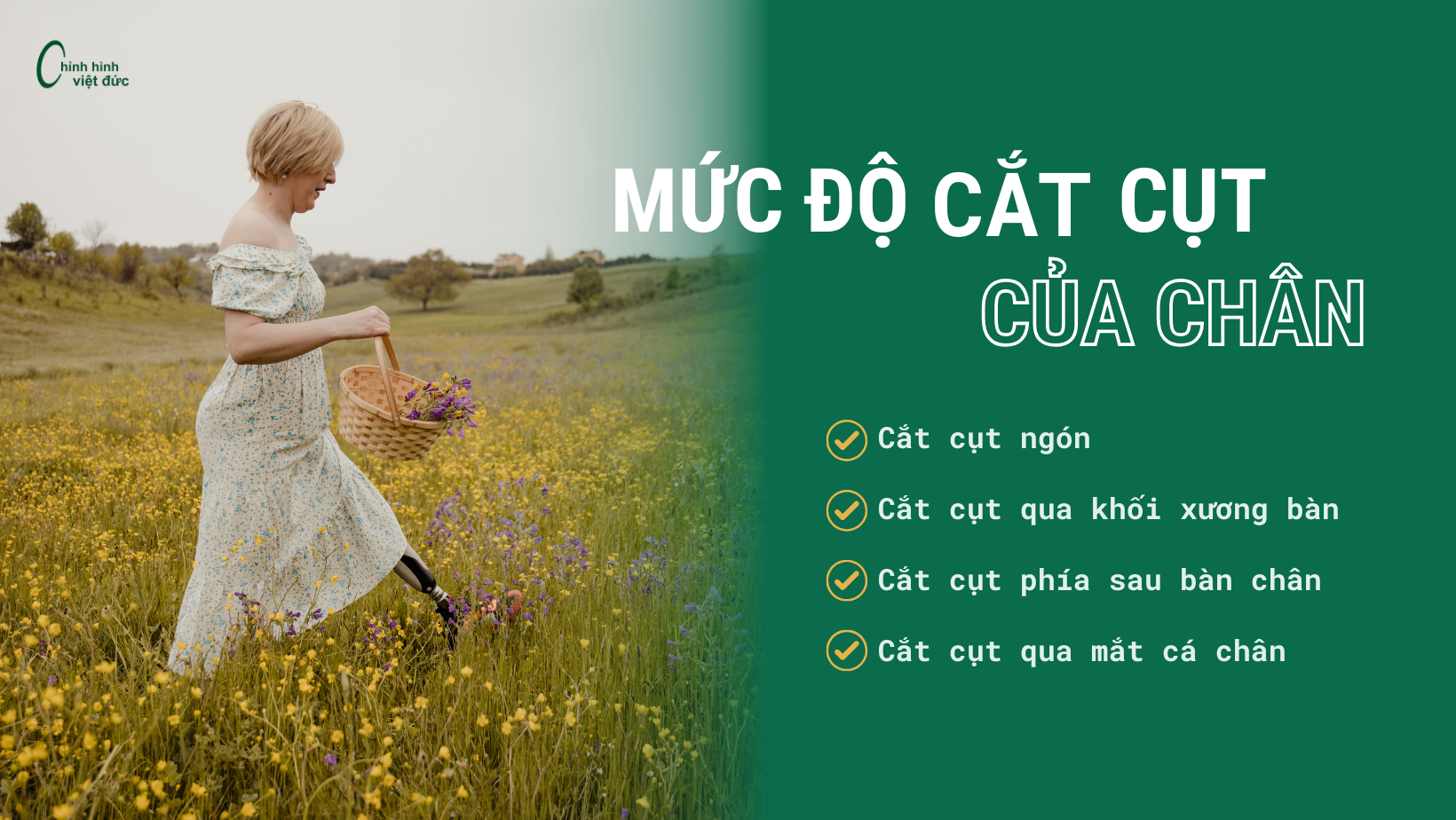 chân giả phần bàn giá bao nhiêu?