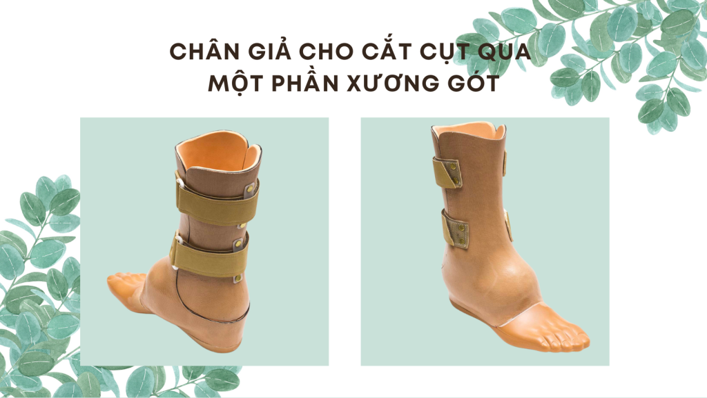 làm chân giả phần bàn có đắt không?