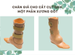 làm chân giả phần bàn có đắt không?