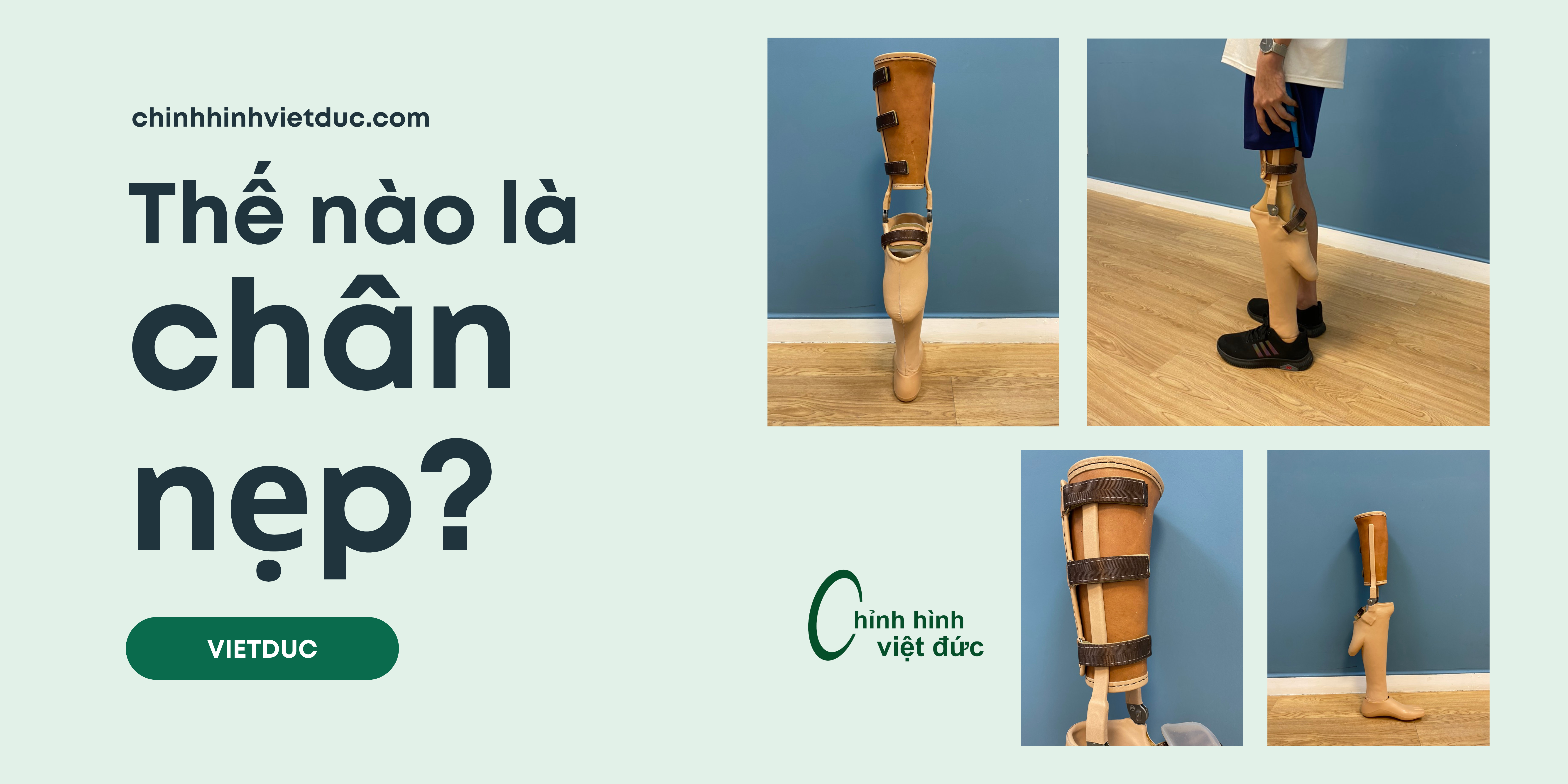 các loại nẹp cho chi dưới