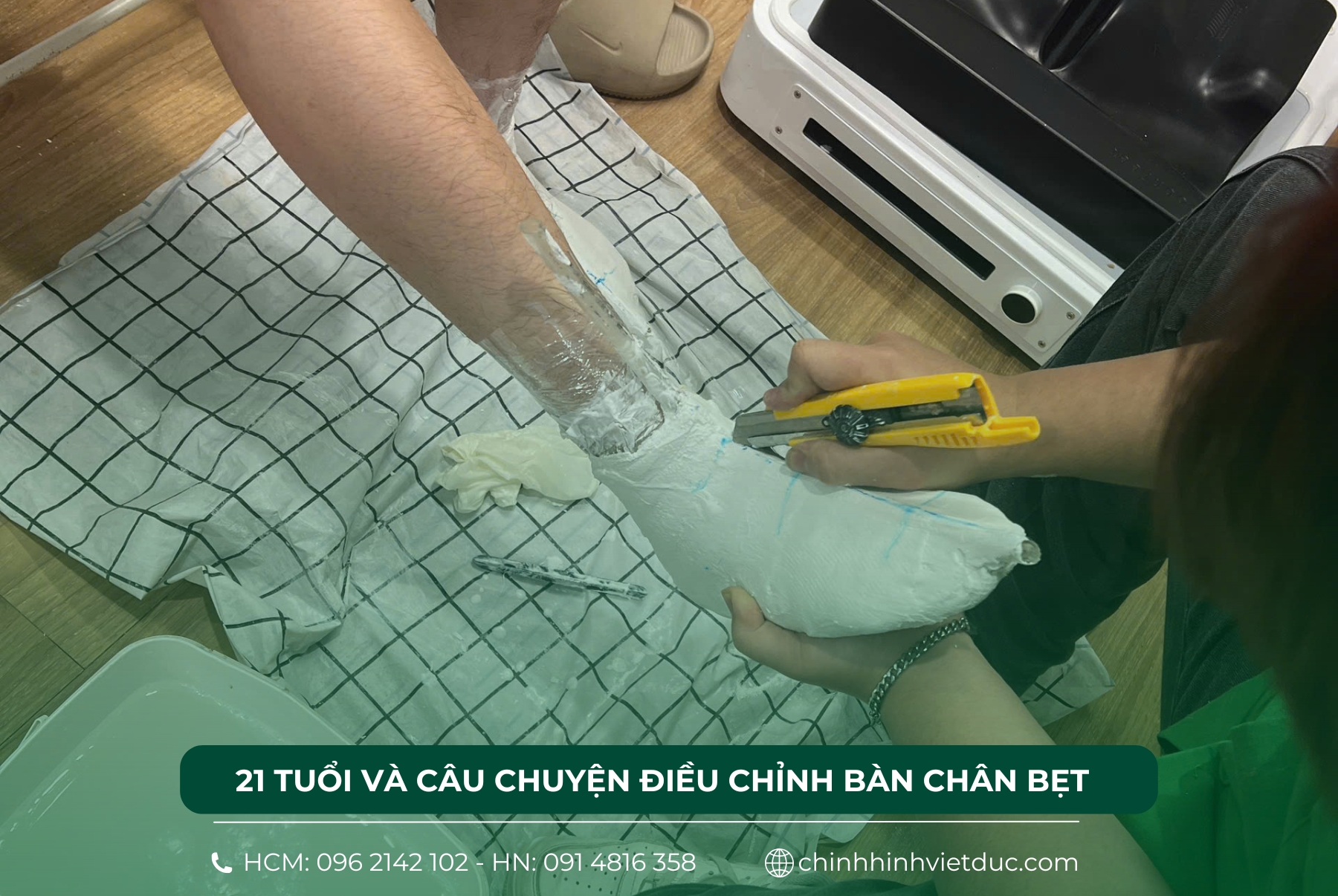 bàn chân bẹt