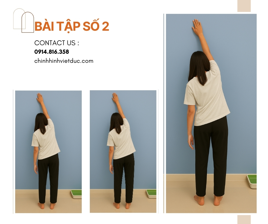 bài tập số 2 chữa cong vẹo cột sống