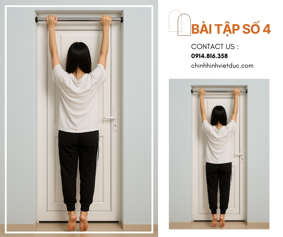bài tập số 4 chữa cong vẹo cột sống