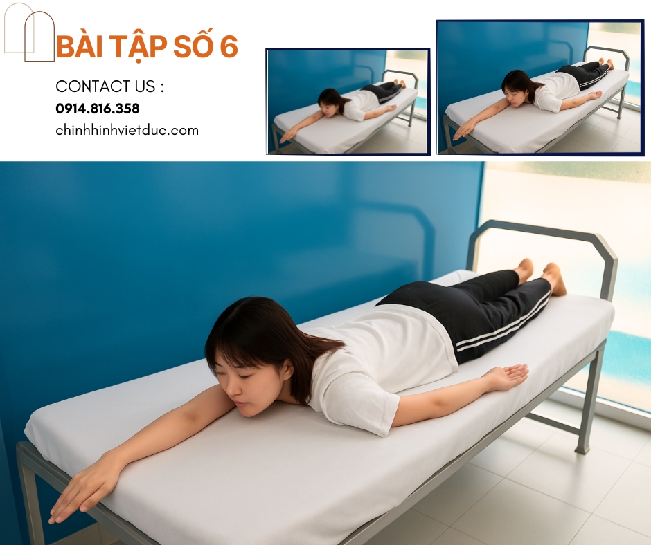 bài tập số 6 chữa cong vẹo cột sống 
