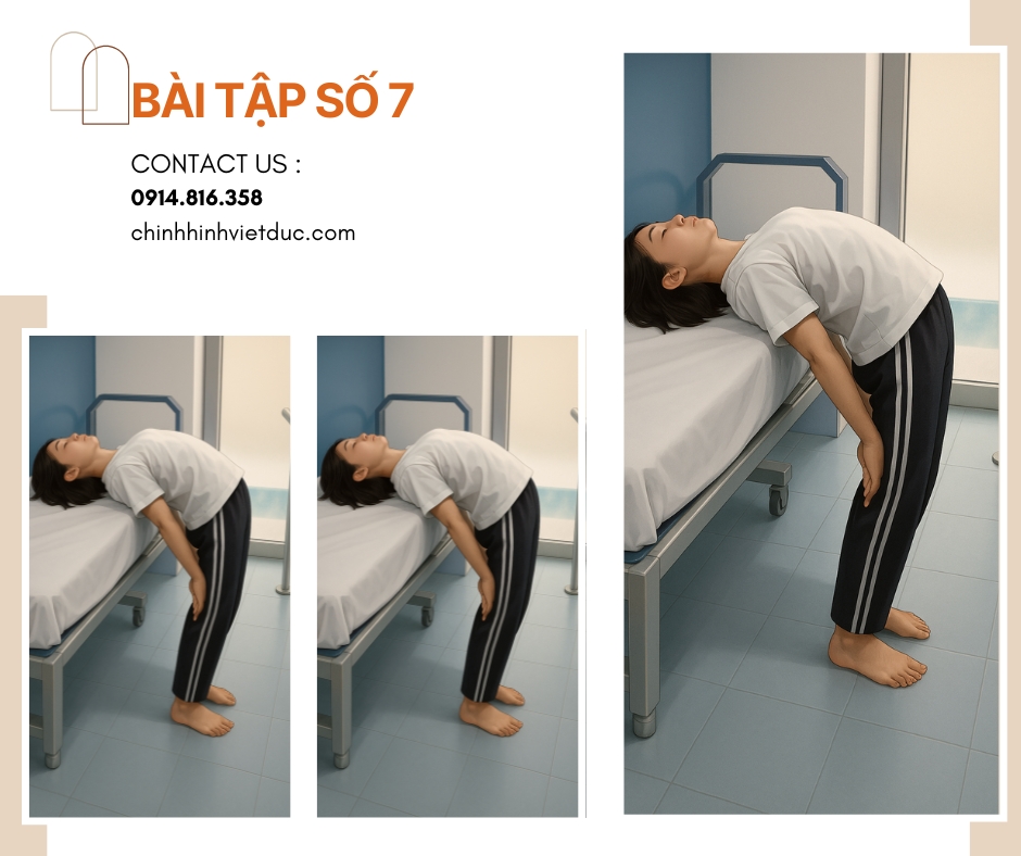 Bài tập số 7 chữa cong vẹo cột sống 
