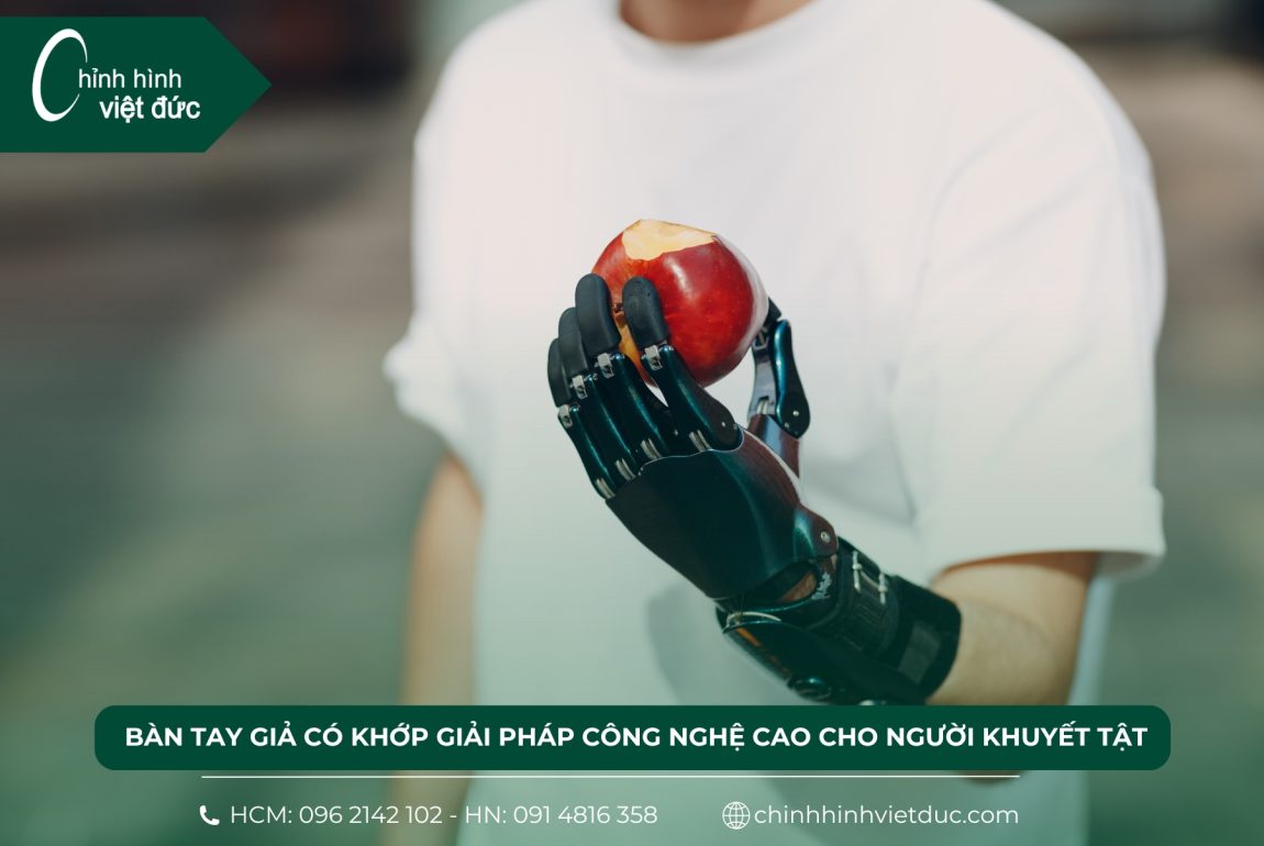 bàn tay giả có khớp