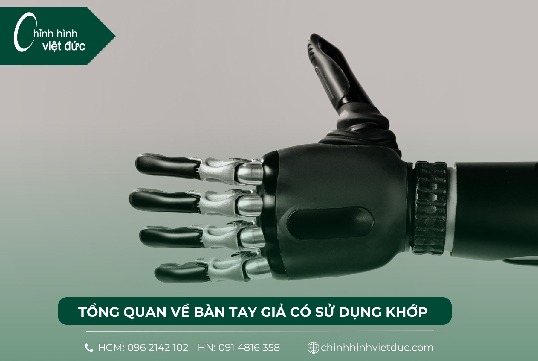 bàn tay giả có khớp tổng quan 