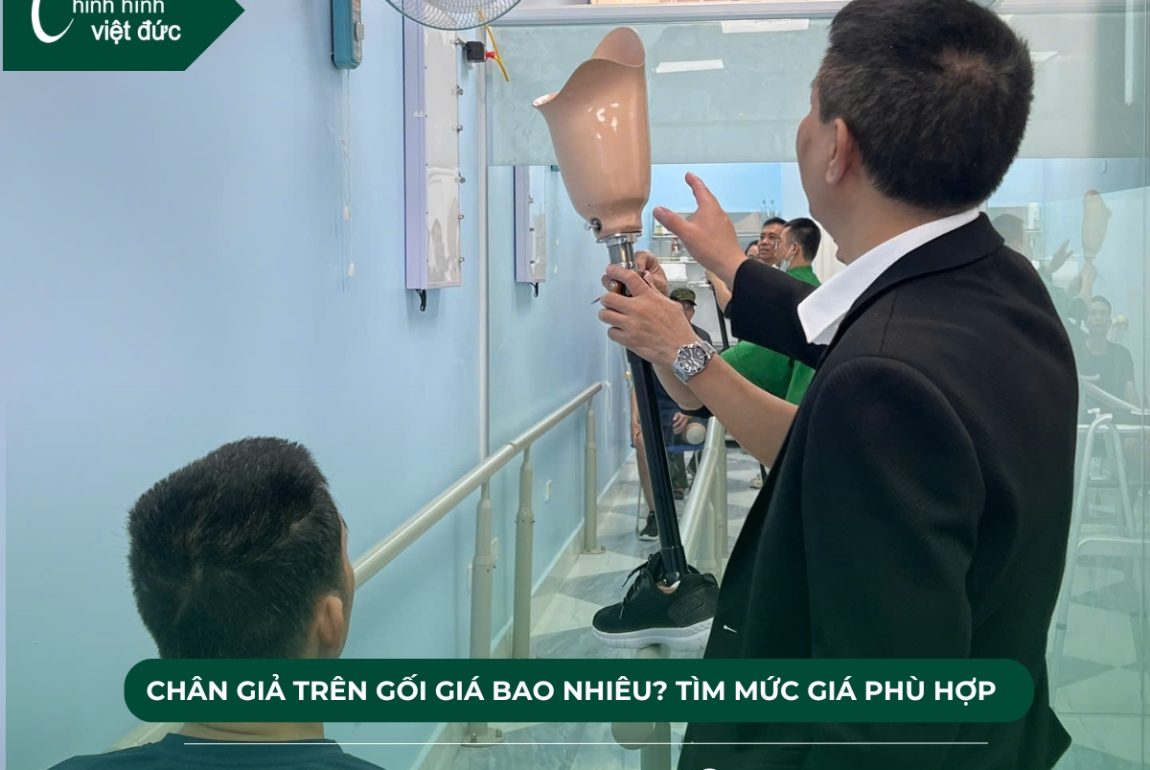 chân giả trên gối giá bao nhiêu