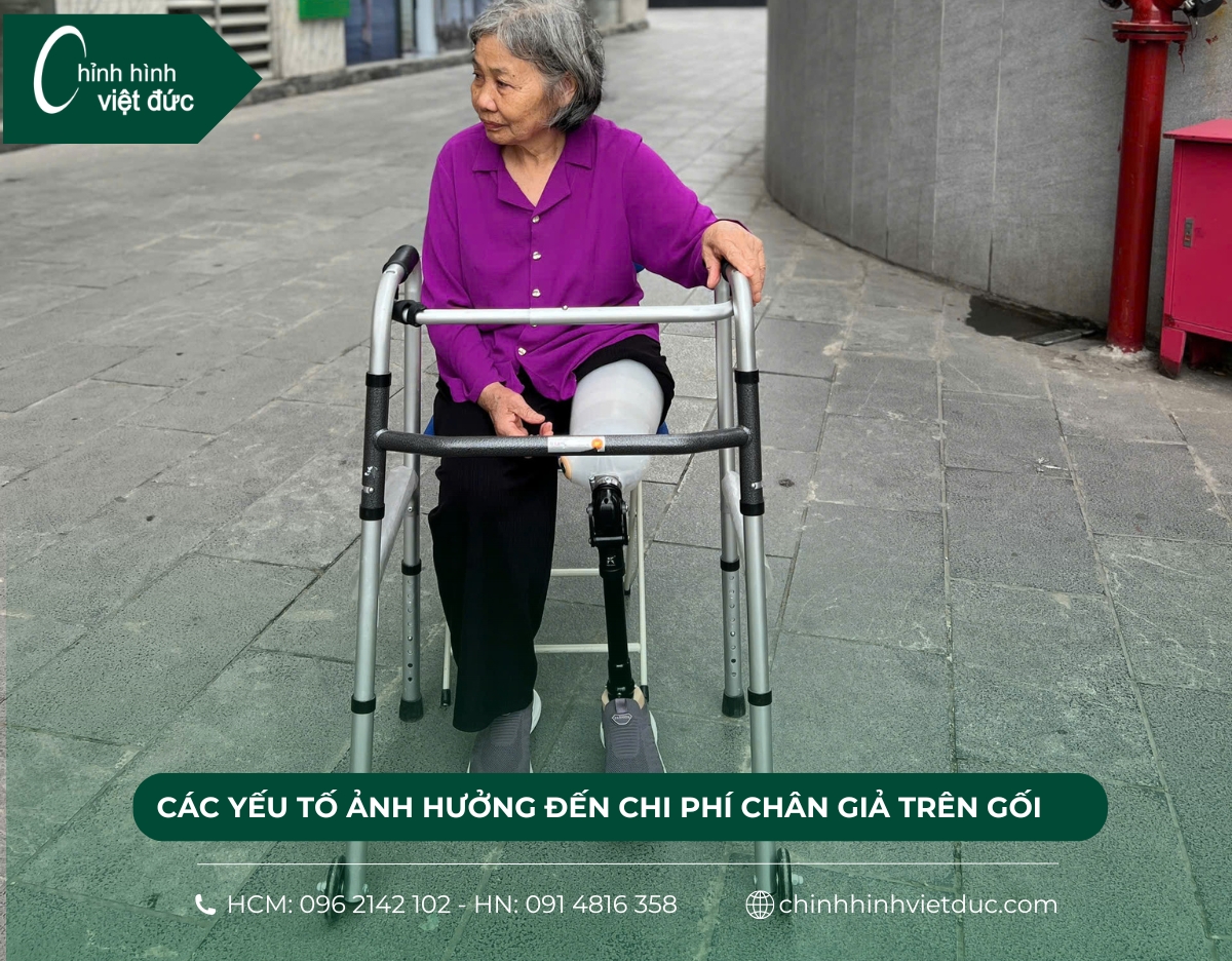chân giả trên gối giá bao nhiêu