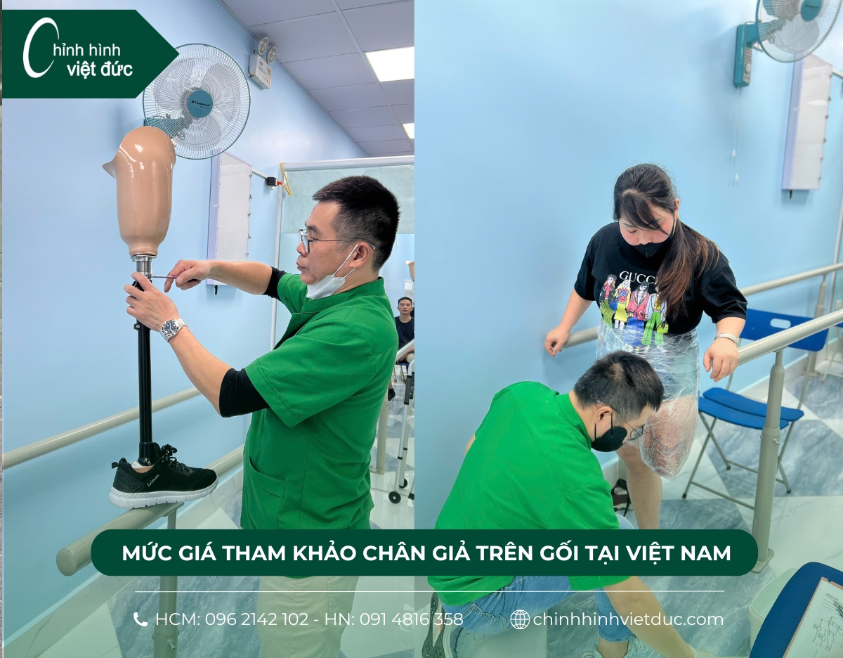 chân giả trên gối giá bao nhiêu