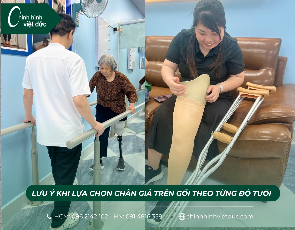 chân giả trên gối giá bao nhiêu