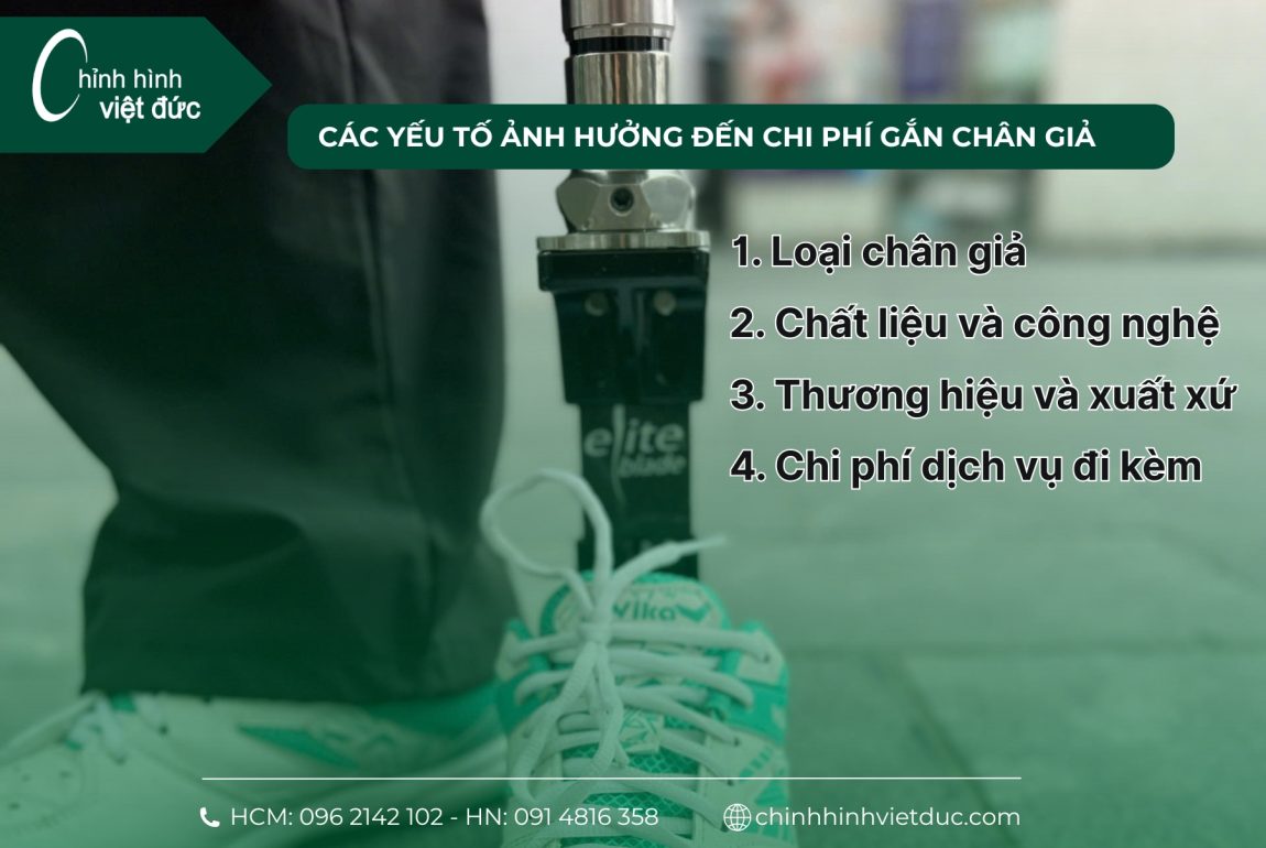 chi phí gắn chân giả