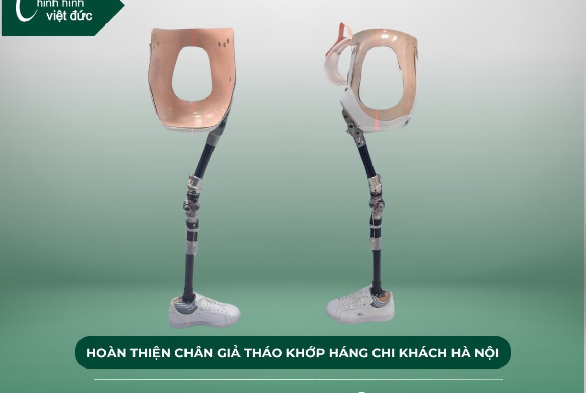 lắp chân giả tháo khớp háng