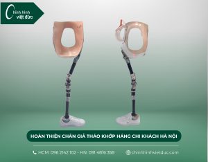 lắp chân giả tháo khớp háng