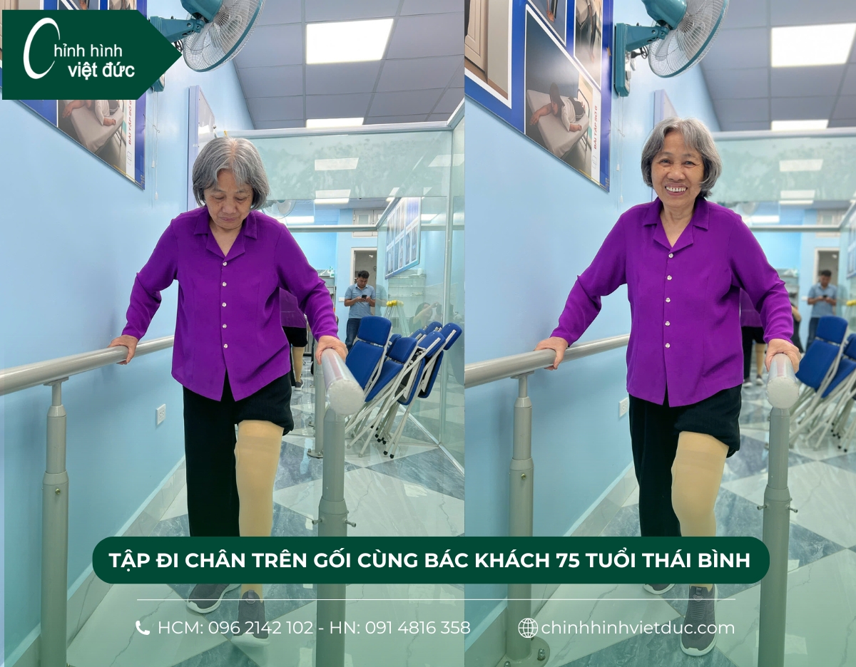 chân giả trên gối