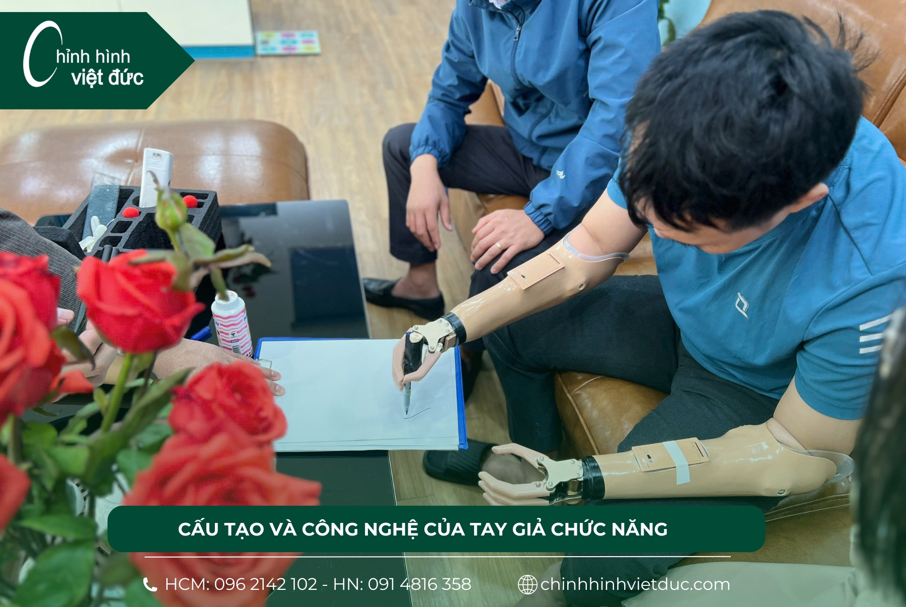 tay giả chức năng