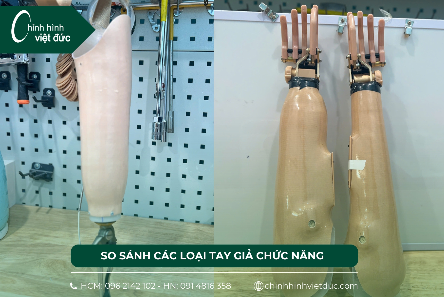 tay giả chức năng