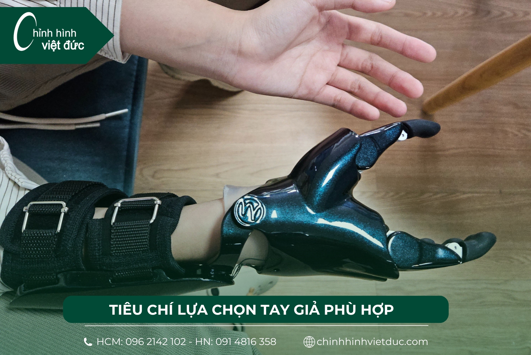 tay giả chức năng