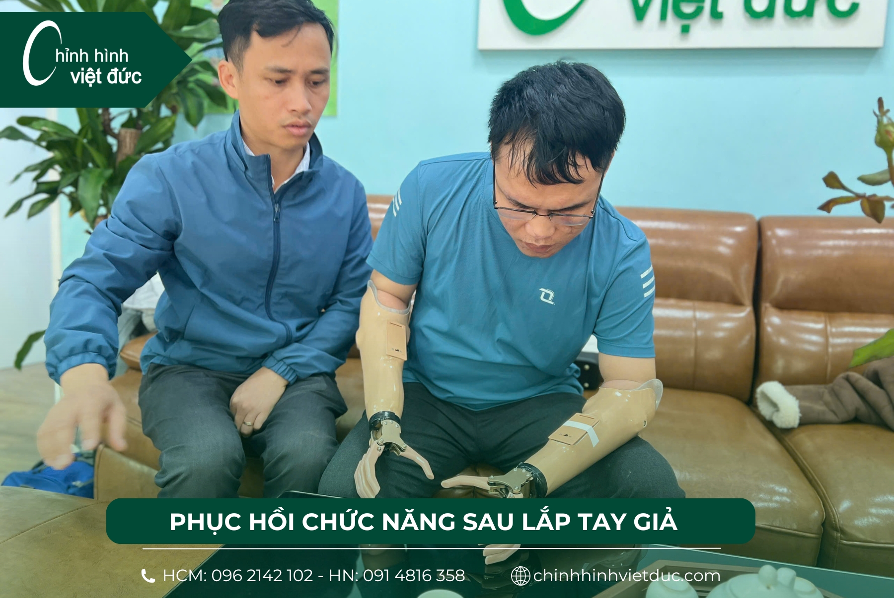 tay giả chức năng