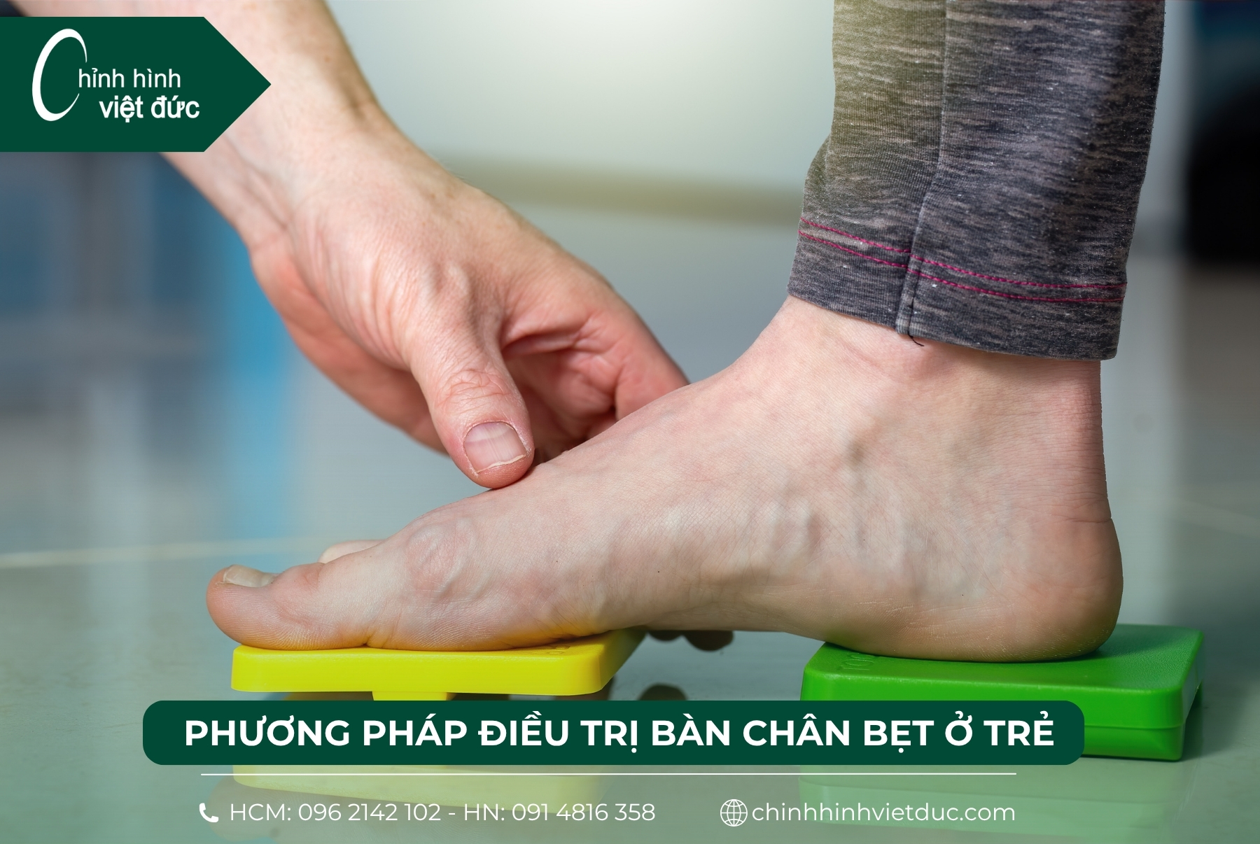 bé bị bàn chân bẹt có sao không