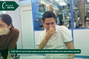 Cánh tay giả mới nhất tay cơ học dưới khuỷu cho anh khách Hà Nội