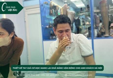 Cánh tay giả mới nhất tay giả cơ học