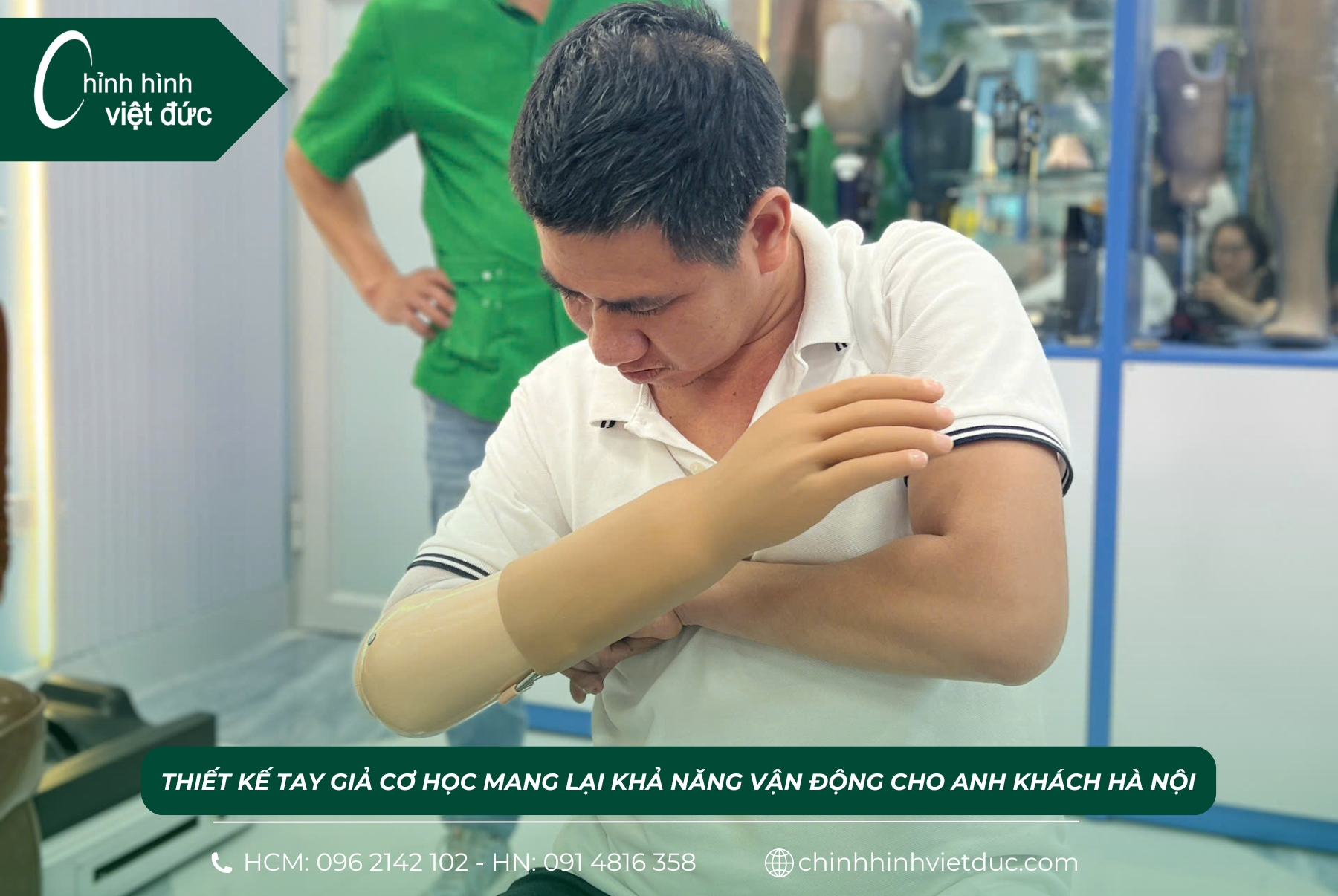 Cánh tay giả mới nhất