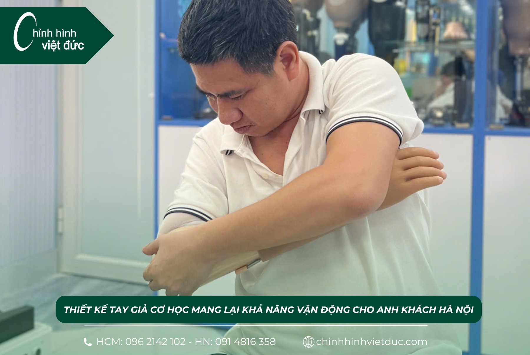 Cánh tay giả mới nhất