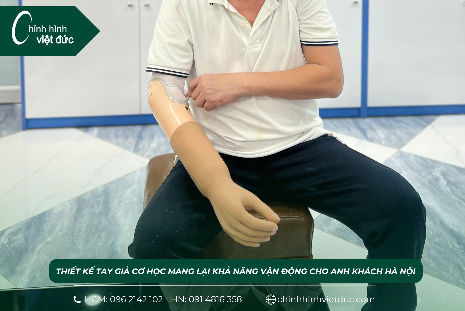 Cánh tay giả mới nhất