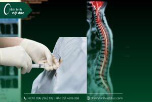 chi phí cho 1 ca phẫu thuật cong vẹo cột sống là bao nhiêu