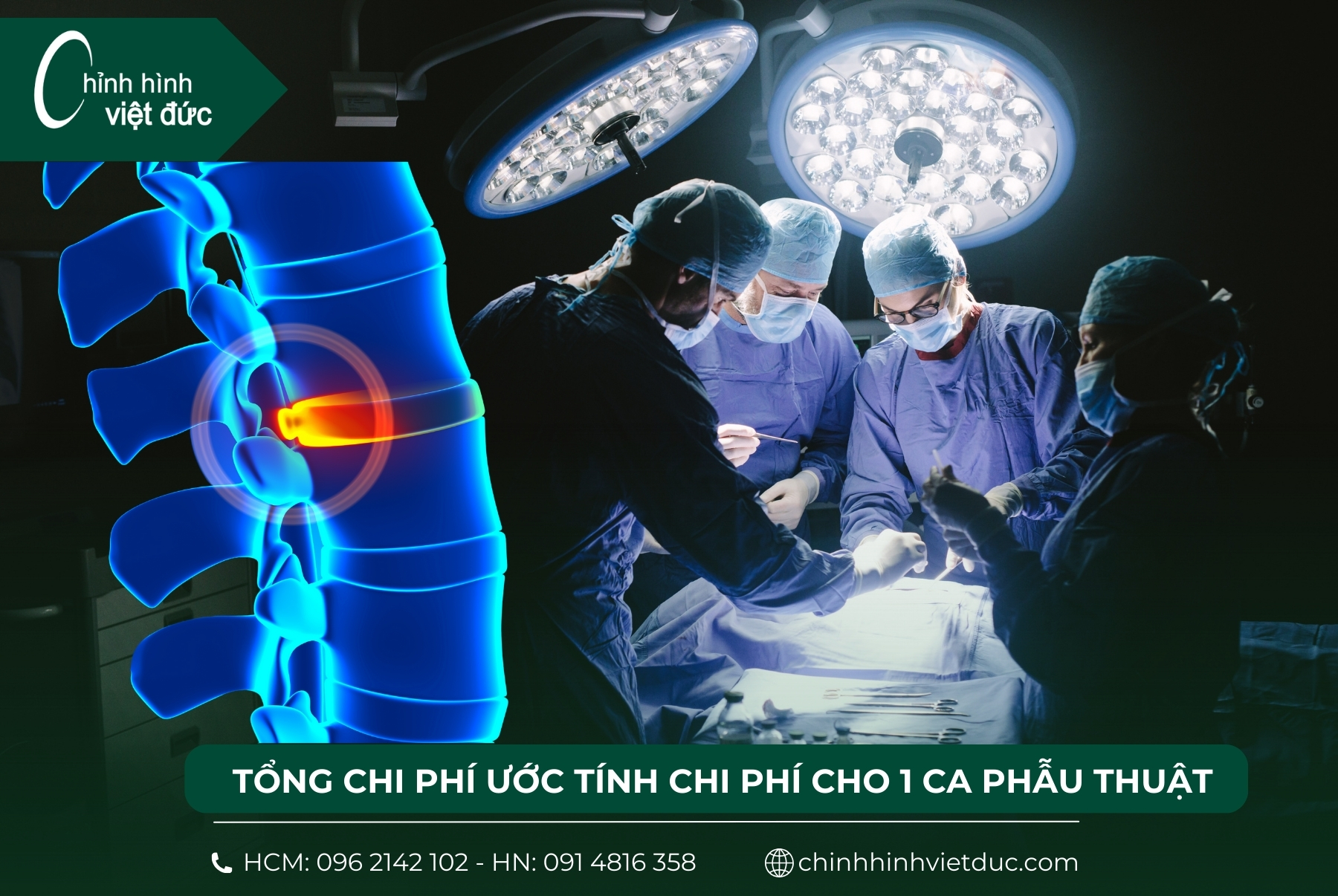 chi phí cho 1 ca phẫu thuật cong vẹo cột sống là bao nhiêu