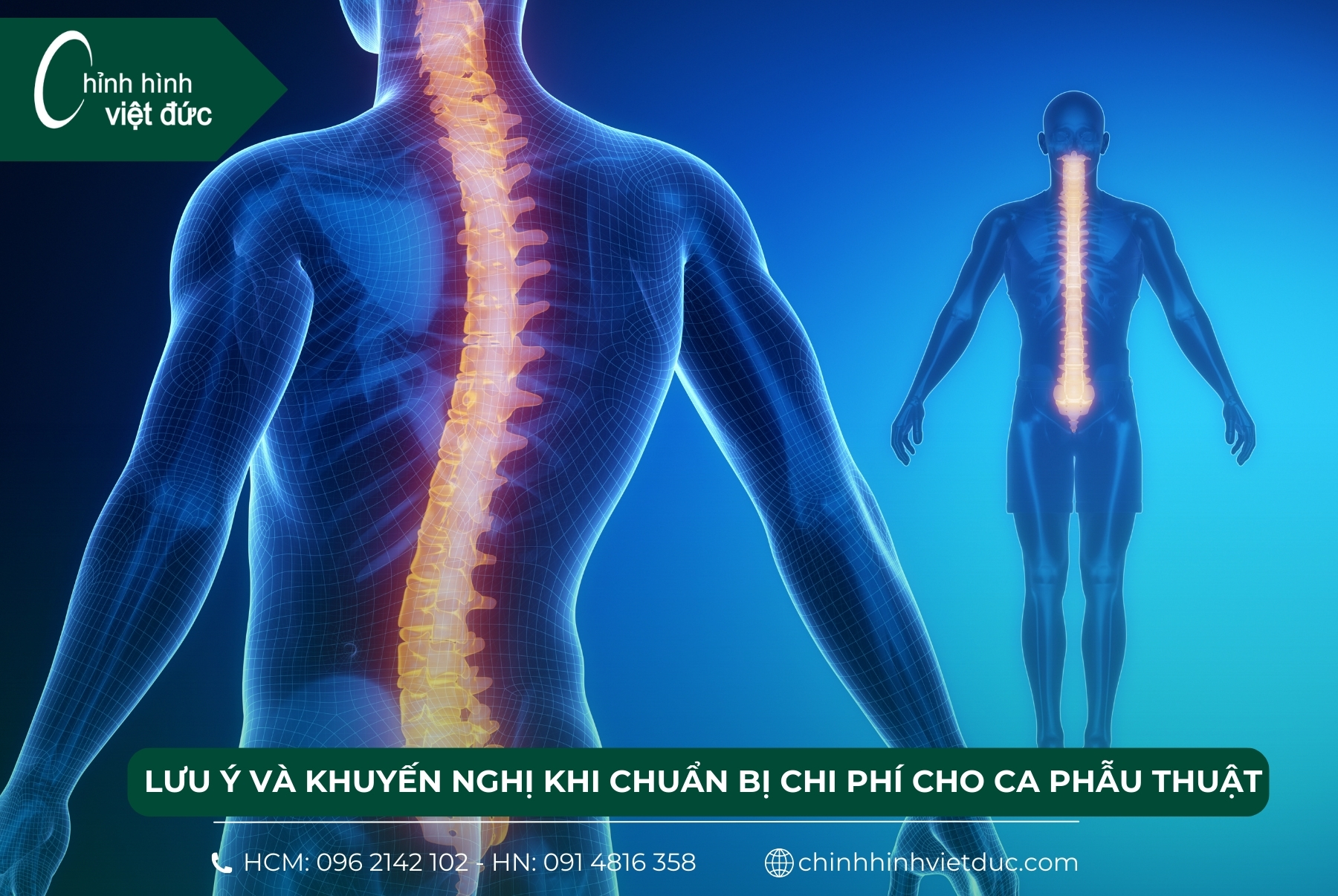 chi phí cho 1 ca phẫu thuật cong vẹo cột sống là bao nhiêu