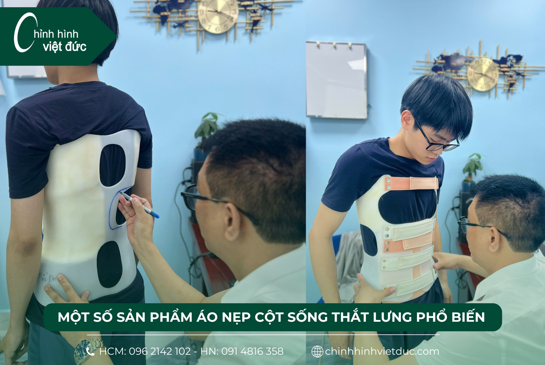 mua áo nẹp cột sống thắt lưng 
